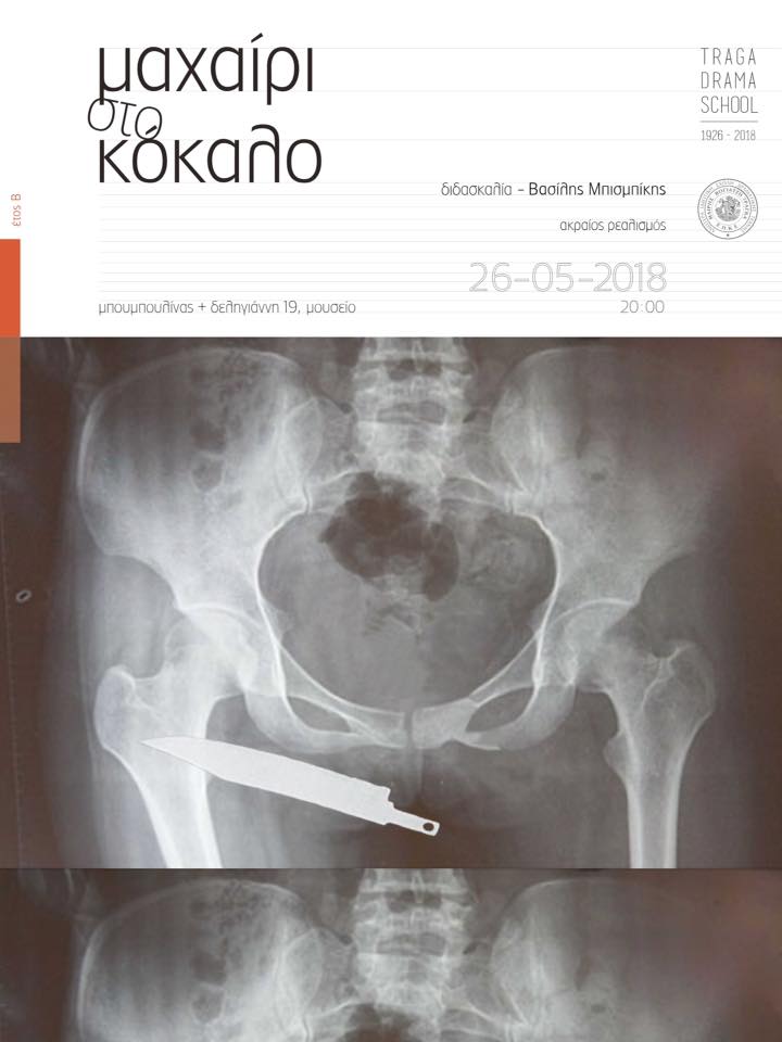Βασίλης Μπισμπίκης